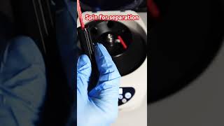 Blood test procedure Hematocrit diy health fitness lifestyle [upl. by Atinal]