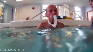 Swimming with an Aquather After Tracheostomy Laryngectomy [upl. by Ayhtnic]