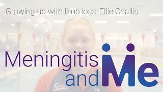 Ellie Challis Growing up with limb loss [upl. by Ylrae]