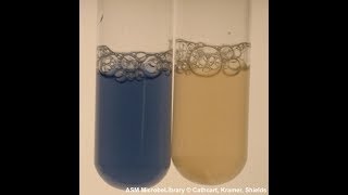 Oxidase test [upl. by Kerek553]