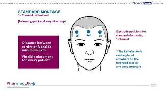 A very Brief 1 min Intro to Narcotrend Brain Function Monitor and flexible montages [upl. by Howarth164]