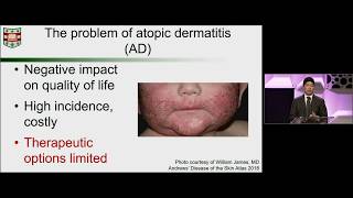 2019 SID State of the Art Plenary Lecture II Immune Regulation of Skin Inflammation and Itch [upl. by Eusadnilem]