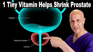 1 Tiny Vitamin Helps Shrink Your Enlarged Prostate  Dr Mandell [upl. by Darda]