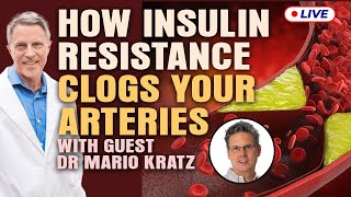 Dr Mario Kratz This Is How Insulin Resistance Clogged Arteries [upl. by Opalina875]