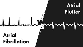 Atrial Fibrillation vs Atrial Flutter  ECG EKG Interpretation  MEDZCOOL [upl. by Auberon]