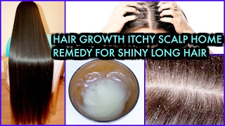 How To Grow Long Hair treat Itchy Scalp Get Shiny Hair  SuperPrincessjo [upl. by Peti912]