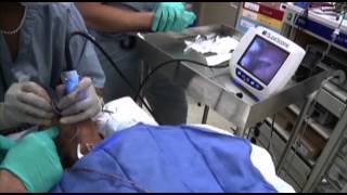 GlideScope Pediatric Airway Rounds Case Study 4 year old Cleft Palate Repair [upl. by Brigitte]