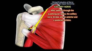 NERVE INJURY IN THE UPPER EXTREMITY Everything You Need To Know  Dr Nabil Ebraheim [upl. by Ahsel]