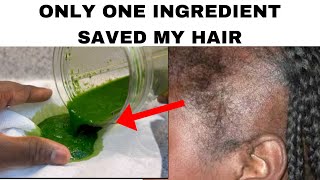 HAIR TONIC YOUR HAIR CAN GROW WITH ONLY ONE INGREDIENT I TRIED IT AND IT WORKED 😱 [upl. by Nosduh]