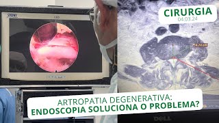 Artropatia Degenerativa Endoscopia soluciona o problema  040324 [upl. by Lait819]