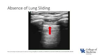 Keyword Review Respiratory Lung Ultrasound  Dr Bowe [upl. by Adigun547]