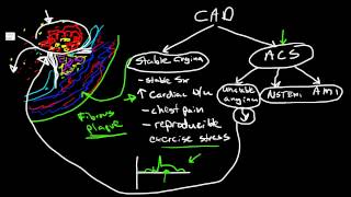 Pathophysiology of Coronary Artery Disease [upl. by Malloch]