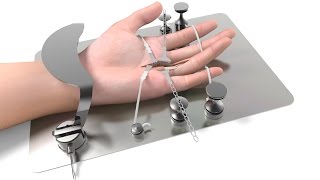 Hand Surgery System micro hand surgery [upl. by Elisha519]