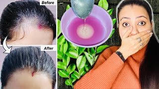 21 Days Summer Extreme Hair Growth Challenge  Grow your Hair faster Thicker and Longer in 3 Weeks [upl. by Wawro]