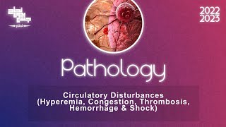 Ch5 part3 Circulatory disturbances HyperemiaCongestion Thrombosis HemorrhageShock Pathology [upl. by Ashling521]