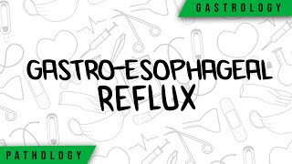 GastroEsophageal Reflux  Physiopathology Symptoms Complications Treatment [upl. by Smaj]