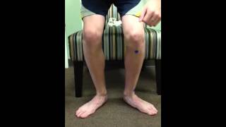 External Tibial Torsion A Video Showing its impact on the knee and foot [upl. by Foah]