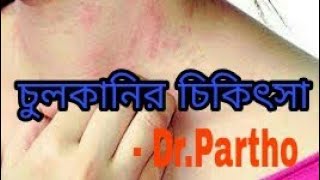 চুলকানির কারণ ও প্রতিকারItching and its treatment।Dr Partho [upl. by Meggy360]