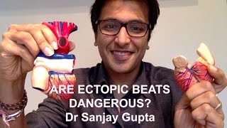 Are ectopic heart beats dangerous [upl. by Perlie383]