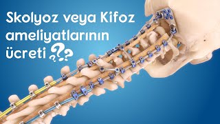 Skolyoz ve kifoz ameliyatlarının ücreti nedir [upl. by Tess20]