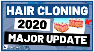 Hair Cloning 2020 Major Updates You Must Know About [upl. by Coleen416]