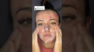 ACNE TIPS THAT WORK😱 follow for more💗 acne acnetreatment skincare skincareroutine skin [upl. by Haskell994]