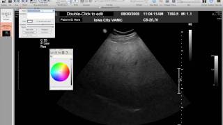 Fixing ID with Osirix [upl. by Naneik293]