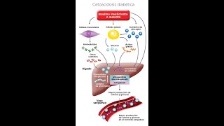 cetoacidosis siabetica fisiopatología y manejo [upl. by Chura975]