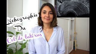 LECHOGRAPHIE DU COL DE LUTERUS  Explications dune Sage Femme CSF [upl. by Igenia]