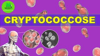 CRYPTOCOCCOSE  cours de mycologie médicale [upl. by Gould24]