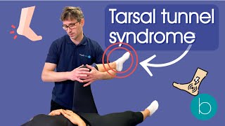 Tarsal Tunnel Syndrome  Everything You Need To Know [upl. by Asiret504]