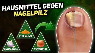 10 Natürliche Hausmittel gegen Nagelpilz Onychomykose [upl. by Noryb393]