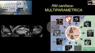 690 RM Cardiaca multiparamétrica [upl. by Mccallion]