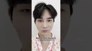 Korean Idol Plastic Surgery😏 [upl. by Haissem]