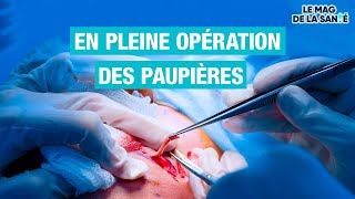 👁️ Une chirurgie pour remonter les PAUPIÈRES  Allo Docteurs [upl. by Nnylirak]