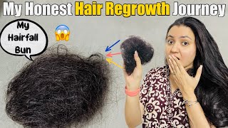 My Hair Loss amp Hair Regrowth Journey  Sharing My Story❤️ [upl. by Witty]