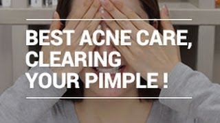 The Best ACNE Care Tips for Clearing Pimple with Eunices naked face XD  Wishtrend [upl. by Euqinu]