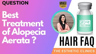 Hair FAQ Best treatment for Alopecia Areata  Hair Loss Solution by The Esthetic Clinics [upl. by Eelyac400]