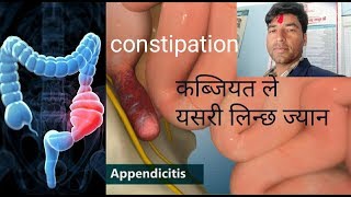 Appendicitis Causesigns symptoms and treatment [upl. by Auhsaj]