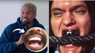 Kanye West Stuns Fans by Getting Titanium Dentures [upl. by Mumford]