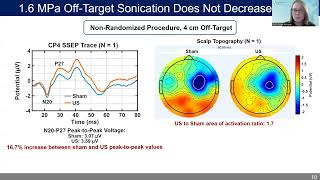 Erica McCune A Reduction of Somatosensory Evoked Potentials Using FUS Median Nerve Stimulation [upl. by Elfrida673]