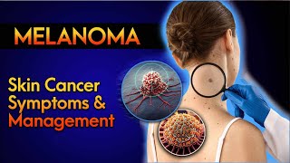 SKIN CANCER AWARENESS  TYPES amp WARNING SIGNSMELANOMASKIN CANCERMELANOMA SYMPTOMSMELANOMA ABCDE [upl. by Chandra]