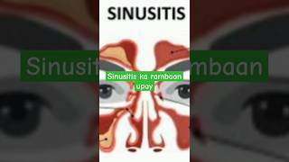 How to get rid of sinusitis sinusitis allergicrhinitis allergy ytshorts health pranyam yoga [upl. by Garfinkel]