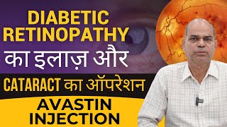 Diabetic Retinopathy Treatment With Avastin Injection इंजेक्शन से किये डायबिटीज रेटिनोपैथी का इलाज [upl. by Nahta505]