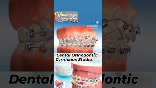 Dental Orthodontic Correction Studio fastest Smile Correction centre Alamcode Attingal Varkala [upl. by Einhpad]