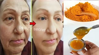 56 years old looks 22  Antiaging treatment to remove wrinkles around the eyes and forehead [upl. by Oiligriv]