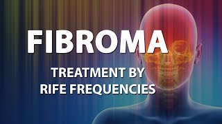 Fibroma  RIFE Frequencies Treatment  Energy amp Quantum Medicine with Bioresonance [upl. by Aisinut848]