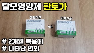 탈모영양제 판토가 2개월 복용 솔직후기ㅣ해외직구제품과 차이점ㅣ쉐딩현상 효과 부작용 탈모량 모발굵기 힘ㅣ탈모예방 탈모극복 탈모르파티 맥주효모 [upl. by Mack]