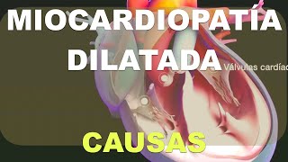 Causas de la miocardiopatía dilatada [upl. by Pierson]