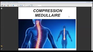 COMPRESSION MÉDULLAIRE [upl. by Eiser]